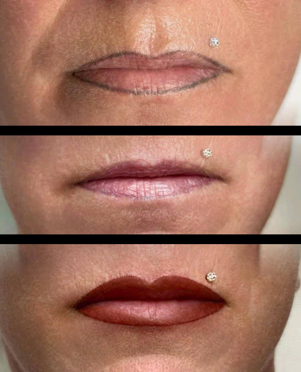 Permanent Makeup Entfernung (vorher/nachher)